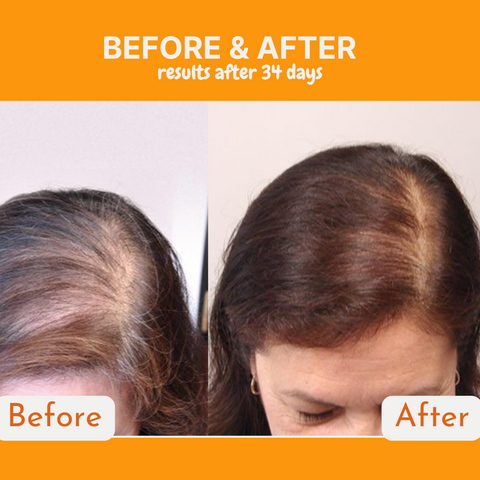 Infueled Pumpkin Seed Oil Capsules