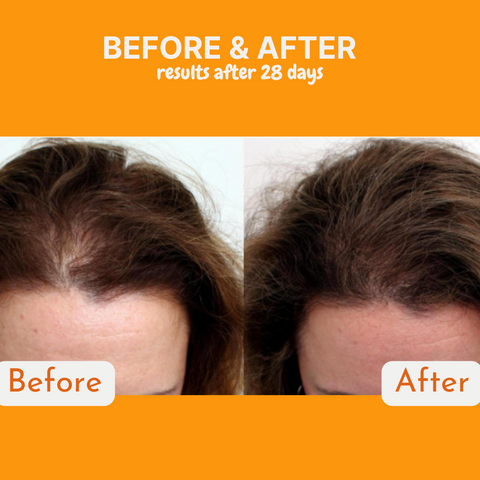 Infueled Pumpkin Seed Oil Capsules