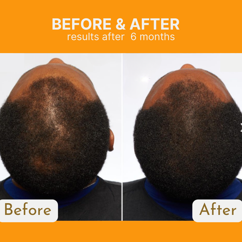 Infueled Pumpkin Seed Oil Capsules AVT3