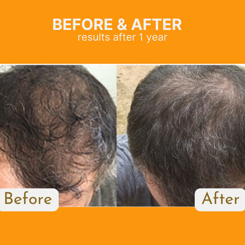 Infueled Pumpkin Seed Oil Capsules AVT3