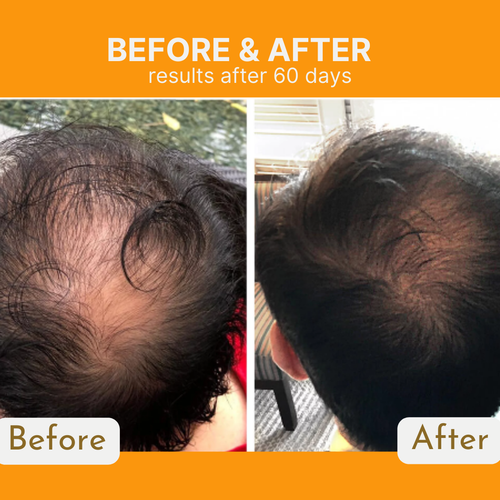 Infueled Pumpkin Seed Oil Capsules AVT3