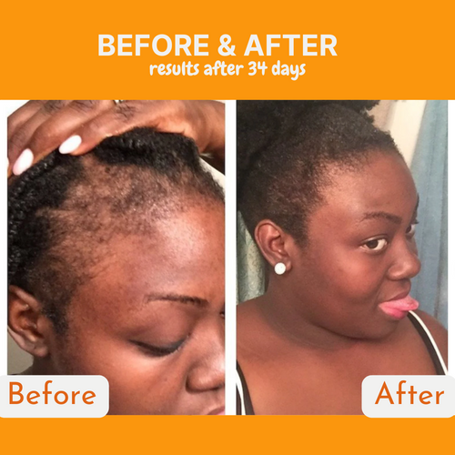 Infueled Pumpkin Seed Oil Capsules