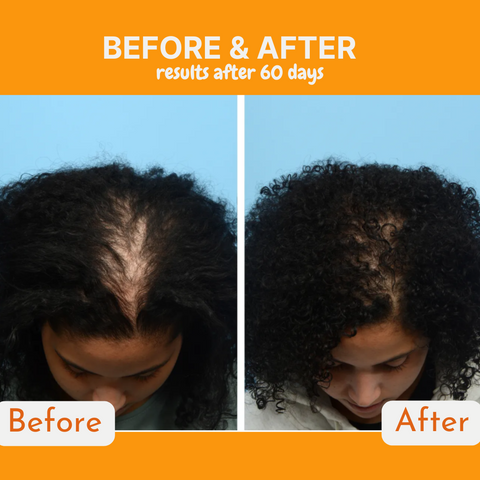 Infueled Pumpkin Seed Oil Capsules