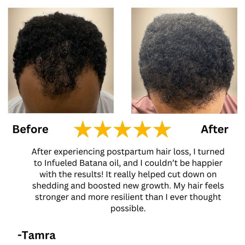 100% Natural Batana Hair Growth Oil